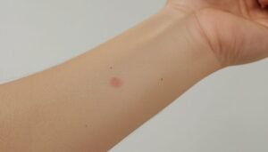 Petechien: Wann kleine rote Punkte gefährlich sind